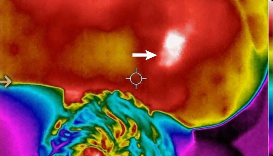 Localized Circulatory Response